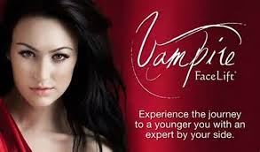 Vampire Face Lift®