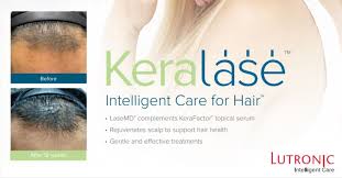 KeraLase® Hair Restoration Treatments- Package of 6 Treatments