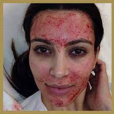 Vampire Facial®- One Powerful Anti-Aging Solution Chosen by Celebrities