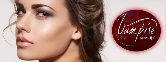 Vampire Face Lift®
