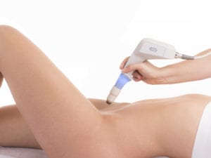 Exilis Ultra®Femme 360 Vaginal Rejuvenation- Package of 3 Treatments