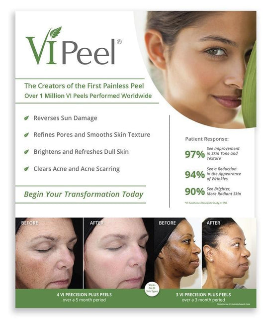 VI Peel – Transform Your Skin with Radiance